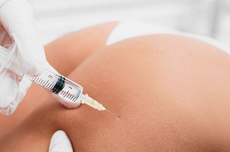 Trattamento di mesoterapia