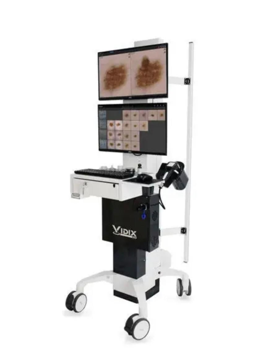 Postazione di videodermatoscopia digitale