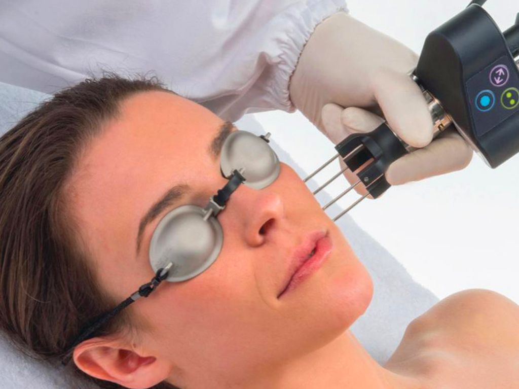 Trattamento laser sul volto