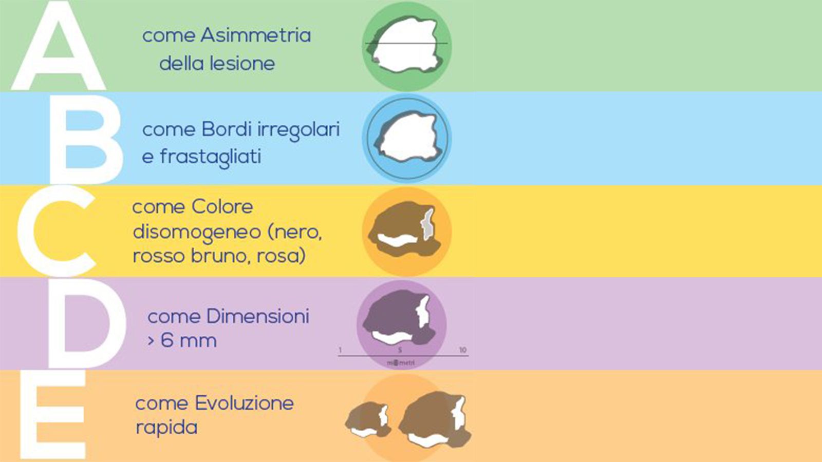 Schema ABCDE per il riconoscimento dei nei sospetti