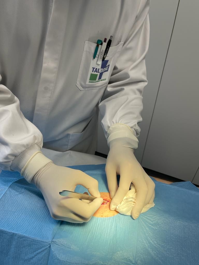 Dettaglio delle mani del chirurgo durante l'intervento