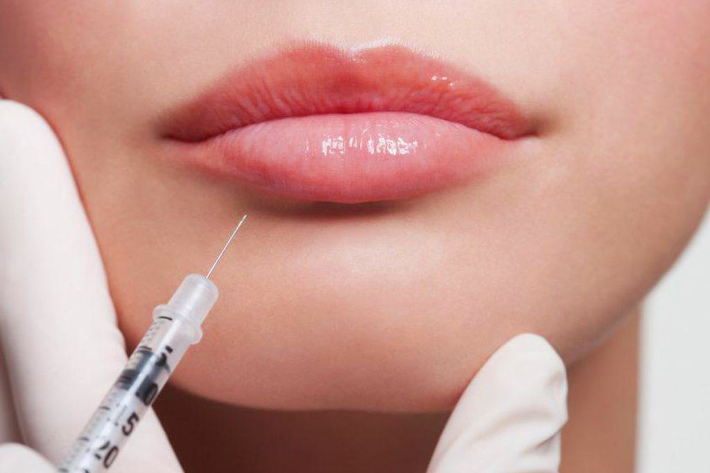 Trattamento delle labbra con acido ialuronico